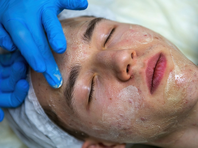 Why Men Hair Transplant